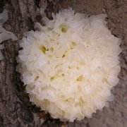 【银耳汤能除眼皱纹吗】银耳汤还有哪些功效_银耳汤怎么做好喝